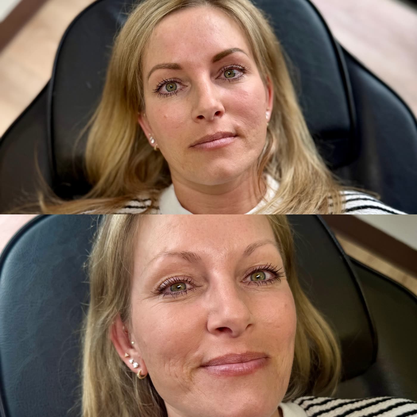Before and after full-face permanent makeup result