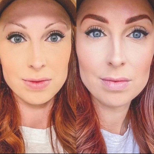 Combo brow result